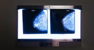 AI Compare Biz-mammogram